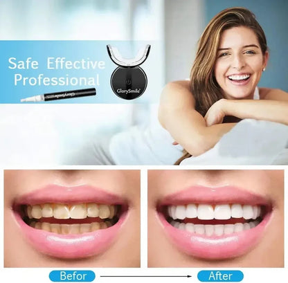 Teeth Whitening Kit — GlorySmile Edition