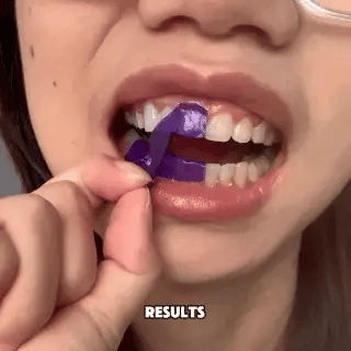 Achieve a Confident, Brighter Smile